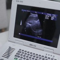 Hand-held Veterinary animal ultrasound with convex probe PM-V0S