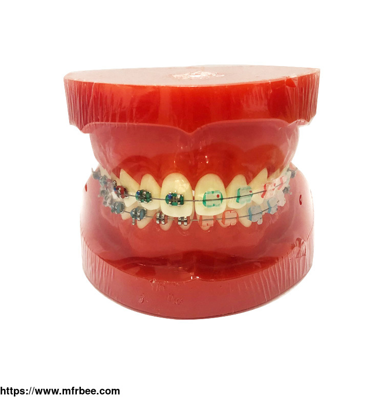 orthodontic_model